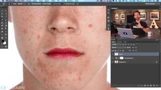 حذف جوش و لک های صورت با فتوشاپ - انگلیسی لیزر فرکشنال