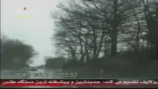 ایرج (ترانه دوستی) درمان ریزش مو
