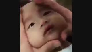 صورت بچه داغون شد....