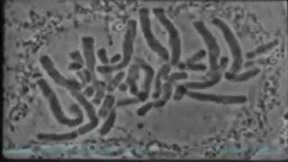 سیتوکینز سلول گیاهی از نگاه میکروسکوپ الکترونی