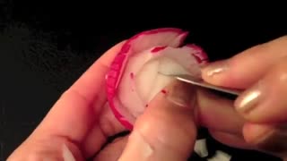 گُل زدن روی تربچـــه-