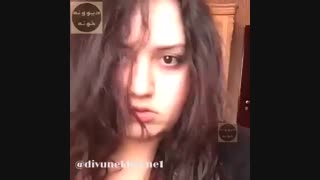 چالش سلفی (5 کیلو به وزنش اضافه شد)