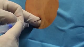 زایمان اپیدورال