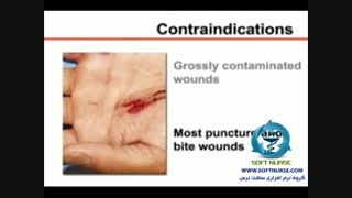 فیلم آموزشی تکنیک بخیه زدن