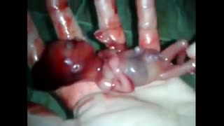 ویدیو جنین زنده..........................خدایا تو واقعا بی نظیری