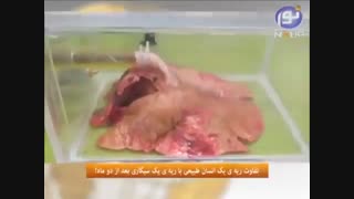 تفاوت ریه ی یک انسان طبیعی با ریه ی یک سیگاری بعد از 2 ماه