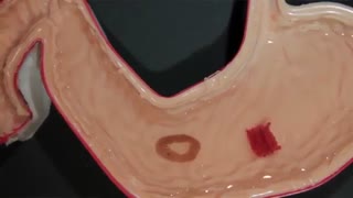 ساخت نوعی ربات اریگامی خوراکی، مورد استفاده در علم پزشکی