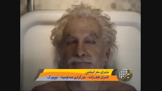 گزارش جالب درمورد مغز انیشتن