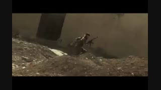 بزم وصال... رادیوگرافی دندان