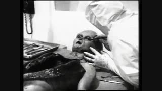 کالبدشکافی یکی از موجودات فضایی حادثه رازول