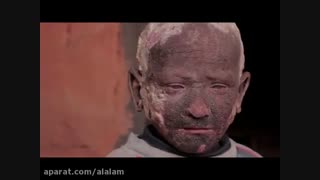 تبدیل شدن یک کودک به سنگ!