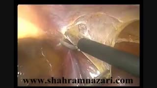 هرنی اشپیگل