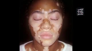 ""مستند تغییر رنگ پوست مایکل جکسون""