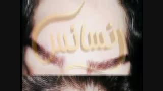 کاشت ابرو به روش sut