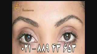 کاشت ابرو طبیعی با روش SUT مرکز کاشت مو رنسانس اصلاح فرم صورت