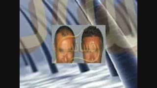 کاشت مو به روشSUT مرکز مو رنسانس