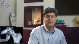 آزمایش‌ها و بررسی‌های قبل از تعویض مفصل لگن | دکتر مهرداد منصوری