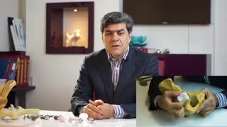 ساختمان مفصل مصنوعی ران چیست؟ اجزا و انواع | دکتر مهرداد منصوری