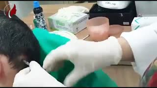 درمان ریزش مو منطقه ای | دکتر صفیه چعباوی زاده متخصص پوست، مو و زیبایی رفع چین و چروک