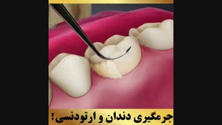 دکتر ارتودنسی | دکتر داوودیان