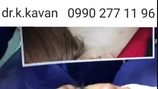جراحی پلک و بینی همزمان توسط دکتر کاوان