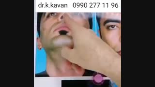 عمل بینی طبیعی و نیمه فانتزی توسط دکتر کاوان