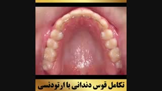 ارتودونسی شرق تهران | دکتر داوودیان