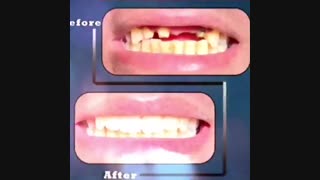 نمونه کارهای زیبایی کلینیک دندانپزشکی بهبد