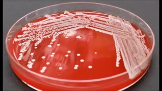 توصیف کولونی ها در محیط کشت