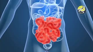 وجود بزوار در روده بیمار در حین کولونوسکوپی