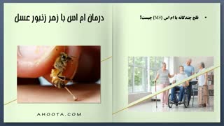 بهبود ام اس با زهر زنبورعسل