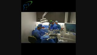 فیلم کاشت ایمپلنت دندان