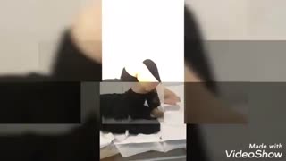 تعویض مفصل زانو درمانی مناسب برای ساییدگی شدید زانو