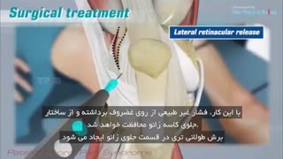 دردهاى جلو زانو در بیماران قسمت سوم