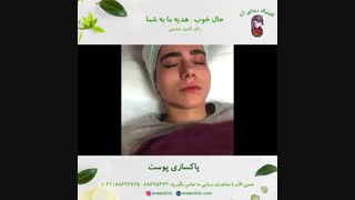 پاکسازی پوست - کلینیک زیبایی آنا بلیچینگ دندان