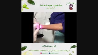 لیزر موهای زائد دست - کلینیک زیبایی آنا