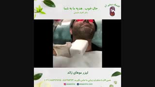 لیزر موهای زائد خط ریش - کلینیک زیبایی آنا