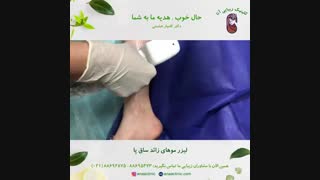 لیزر موهای زائد ساق پا - کلینیک زیبایی آنا