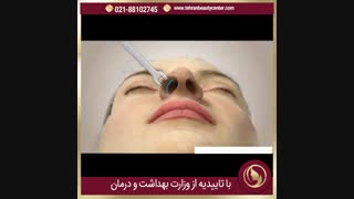 جراحی بینی در مرکز زیبایی تهران