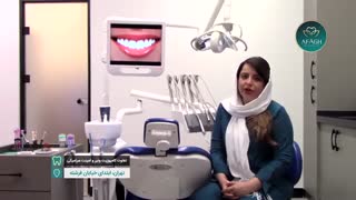 اصلاح طرح لبخند