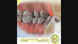 انواع ناهنجاری های دندانی | دکتر لادن طیبی کربوکسی تراپی