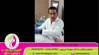 رفع غبغب با کاشت نخ pdo