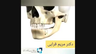 نحوه رویش دندان شیری