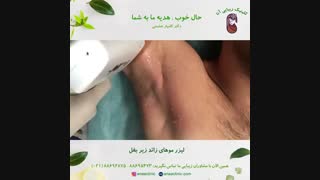 لیزر موهای زائد زیر بغل - کلینیک زیبایی آنا