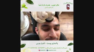 پاکسازی پوست - کنترل چربی صورت - کلینیک زیبایی آنا