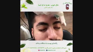 پاکسازی پوست با دستگاه درما اف - کینیک زیبایی آنا