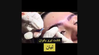 کاشت ابرو طبیعی | کلینیک لیان | 02188978829