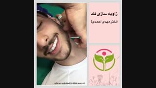 زاویه سازی فک در کلینیک توس