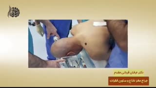 عمل جراحی ستون فقرات