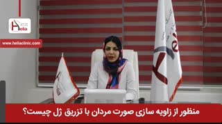 منظور از زاویه سازی صورت مردان با تزریق ژل چیست | کلینیک هلیا | 02122810089
